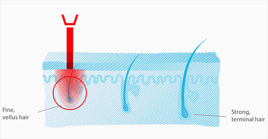 Hair Loss Reversible