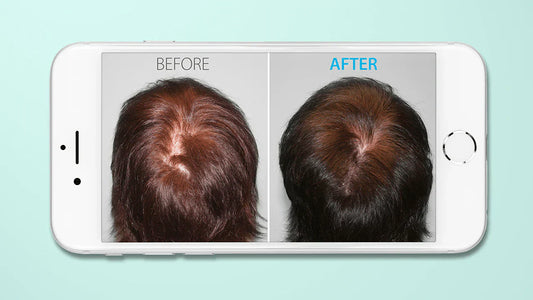 how to take hair loss before and after photos
