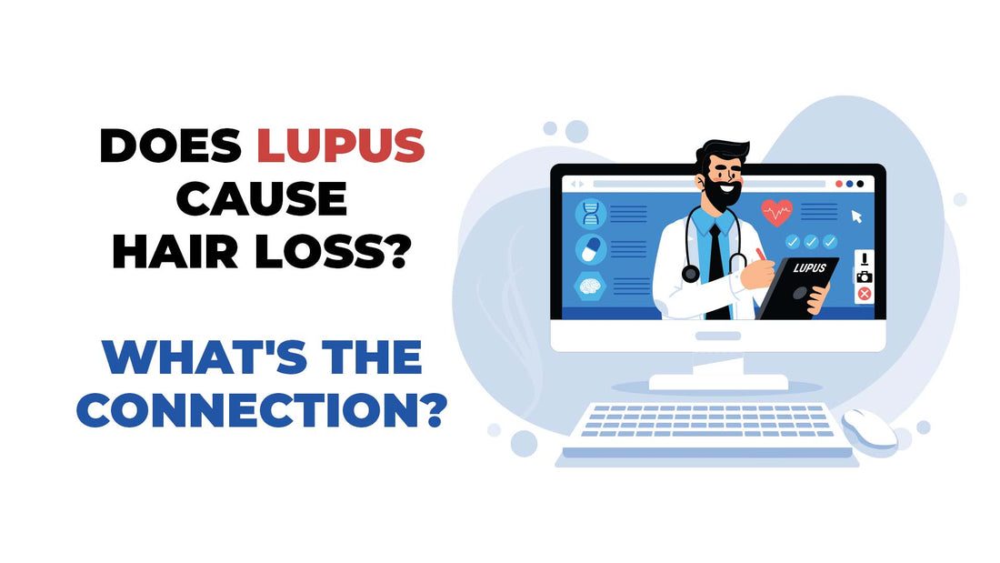 does lupus cause hair loss