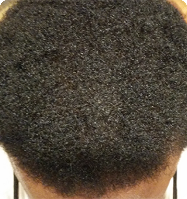 After