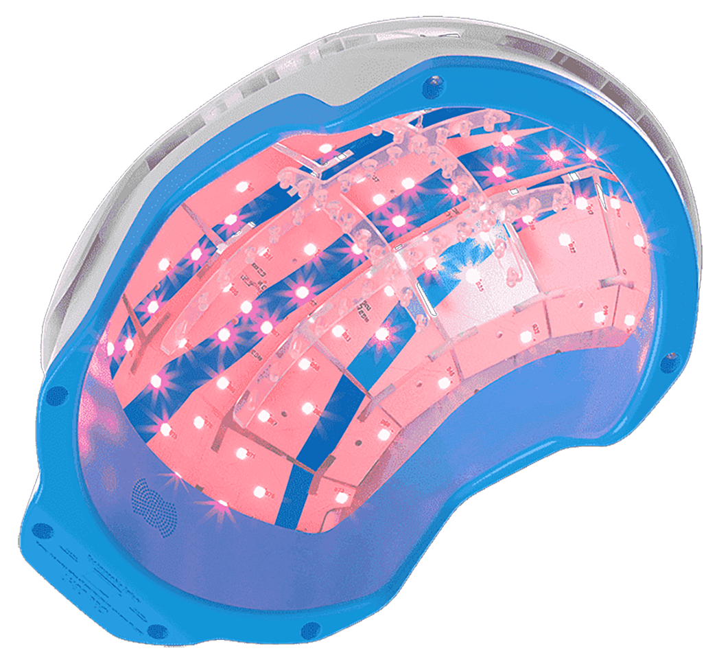 theradome helmet