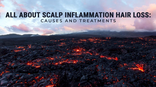 scalp inflammation hair loss