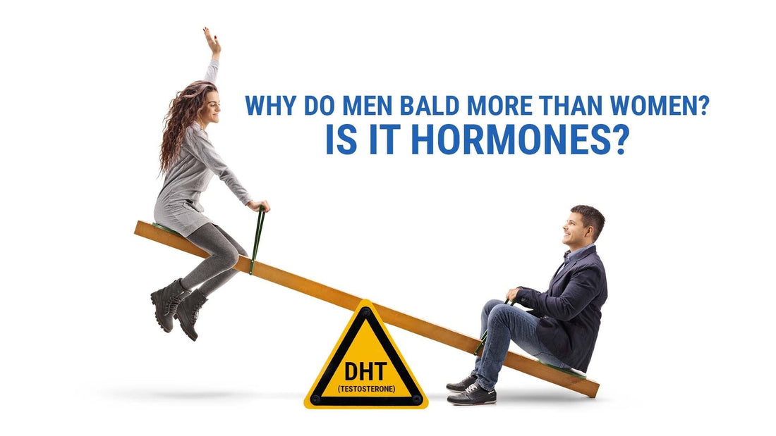 why do men bald more than women