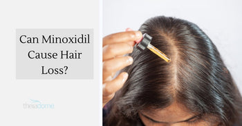 Can Minoxidil Cause Hair Loss? How Long Does Shedding Last – Theradome