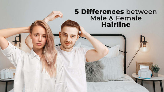 male vs female hairline