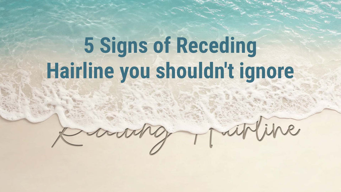 signs of receding hairline you should not ignore