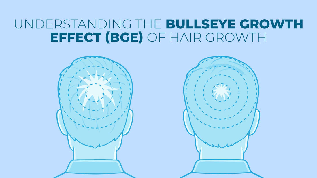 understanding the bullseye growth effect of hair