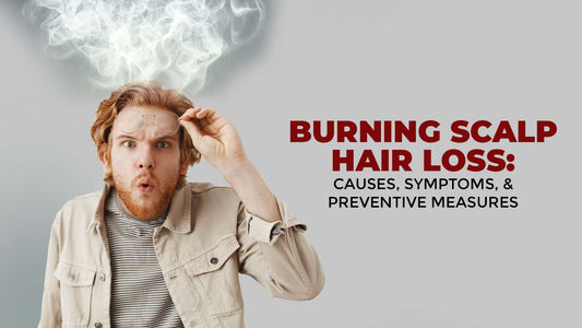 causes, symptoms, and preventive measures of burning scalp hair loss