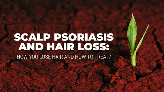 connection between scalp psoriasis and hair loss