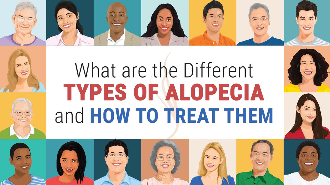 what are different types of alopecia and how to treat them