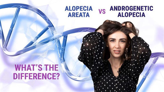 androgenetic alopecia vs alopecia areata