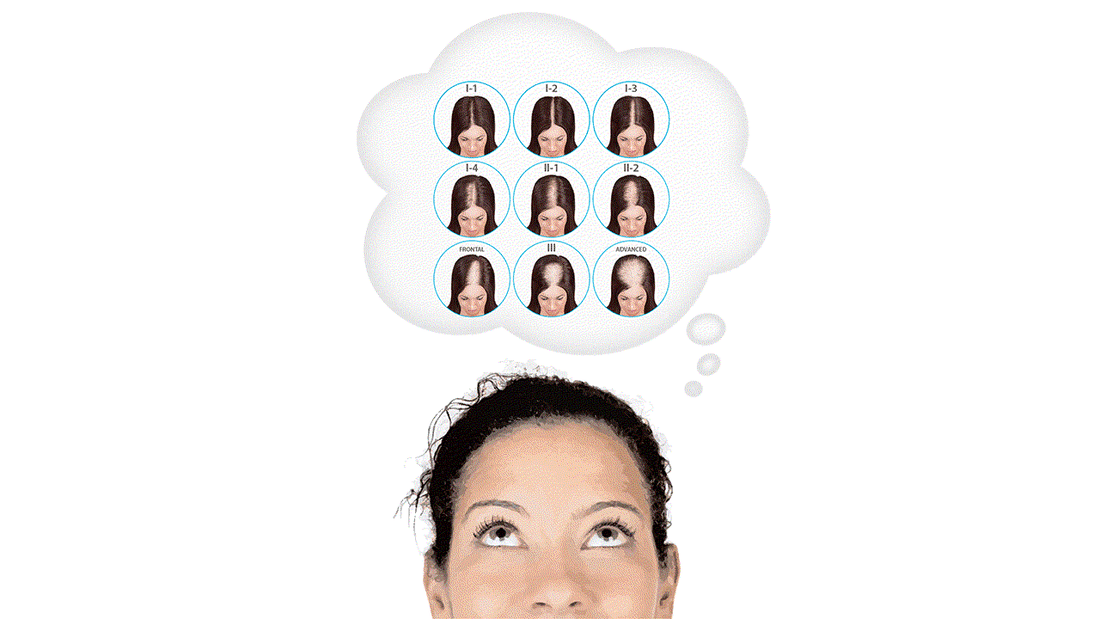 are you a good candidate for theradome laser hair helmet