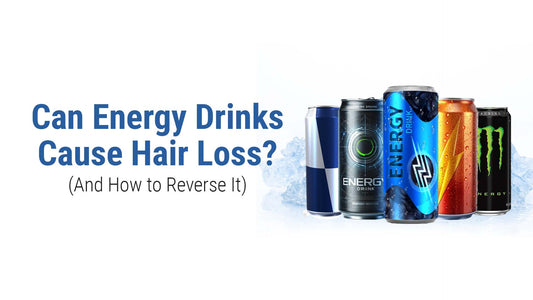 can energy drinks cause hair loss