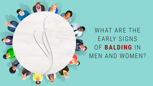 what are the early signs of balding in men and women