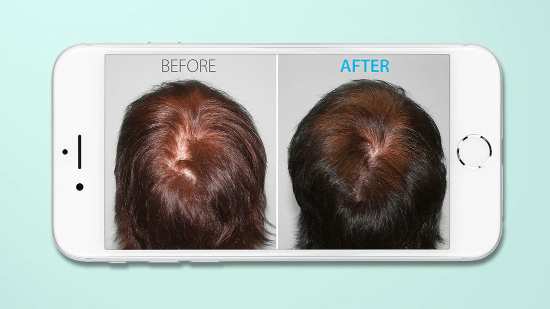 how to take hair loss before and after photos