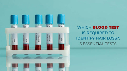 which blood test is required to identify hair loss