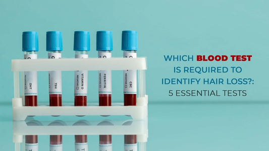 which blood test is required to identify hair loss