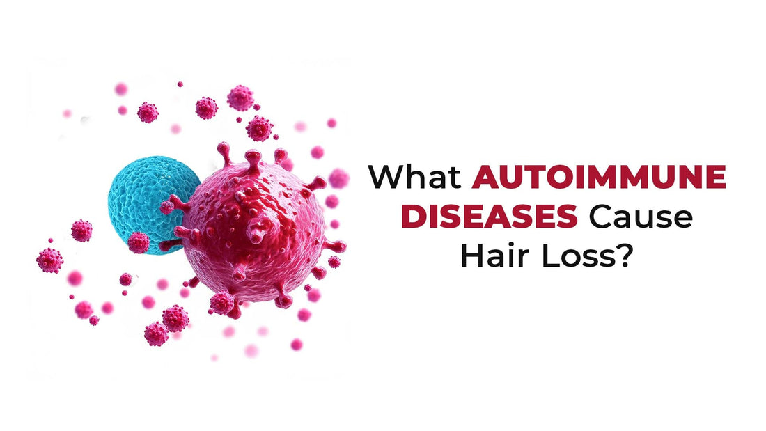 what autoimmune diseases cause hair loss