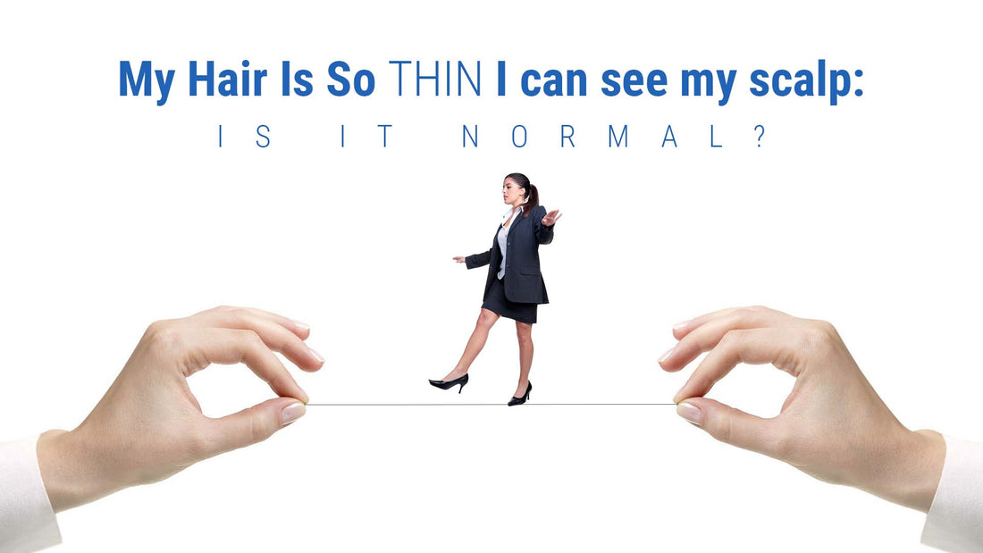 my hair is so thin i can see my scalp