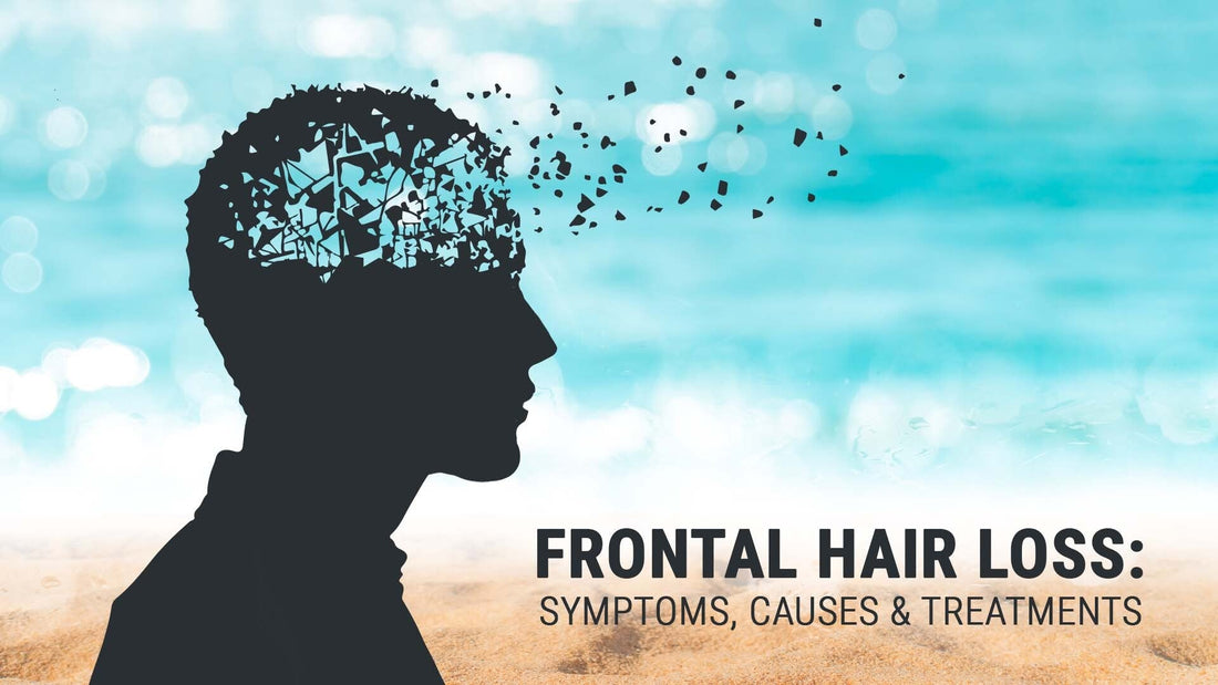symptoms, causes and treatments of frontal hair loss