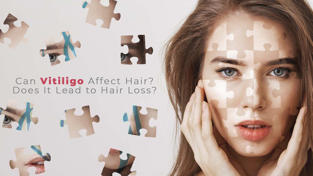 can vitiligo cause hair loss