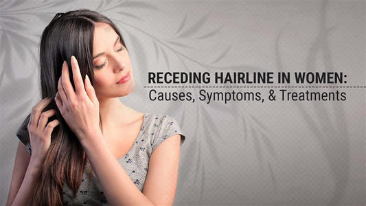 receding hairline in women