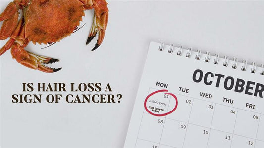 is hair loss a sign of cancer