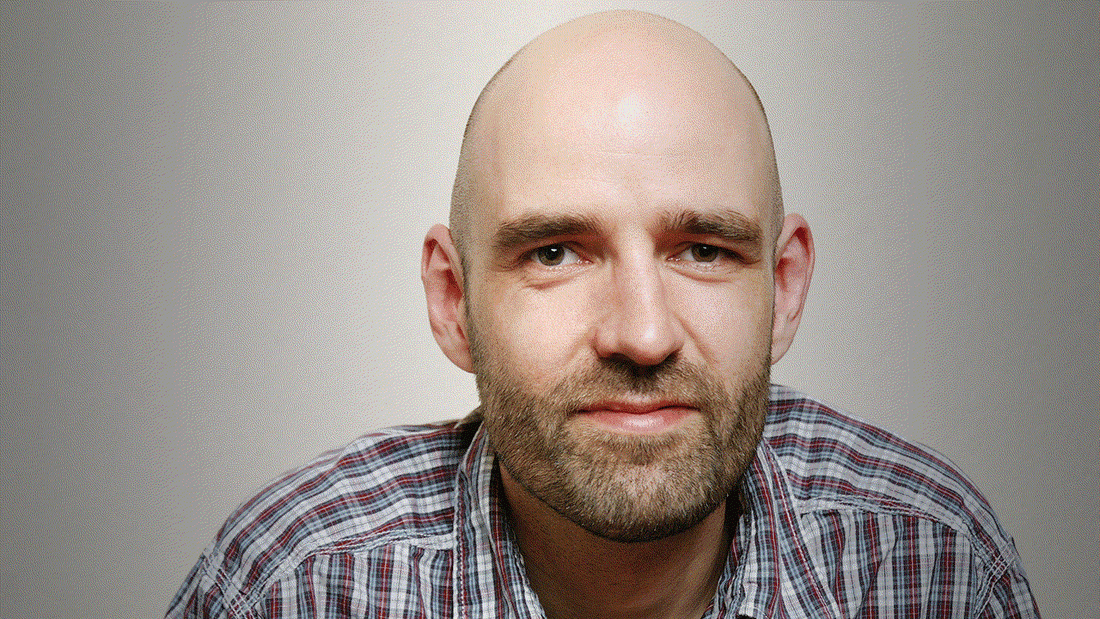 why are bald heads shiny