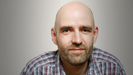 why are bald heads shiny