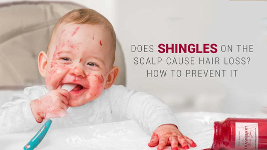 does shingles on the scalp cause hair loss
