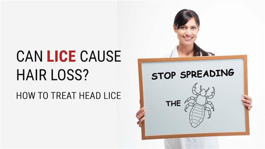 can lice cause hair loss