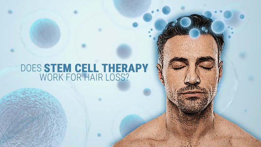 does stem cell therapy work for hair loss