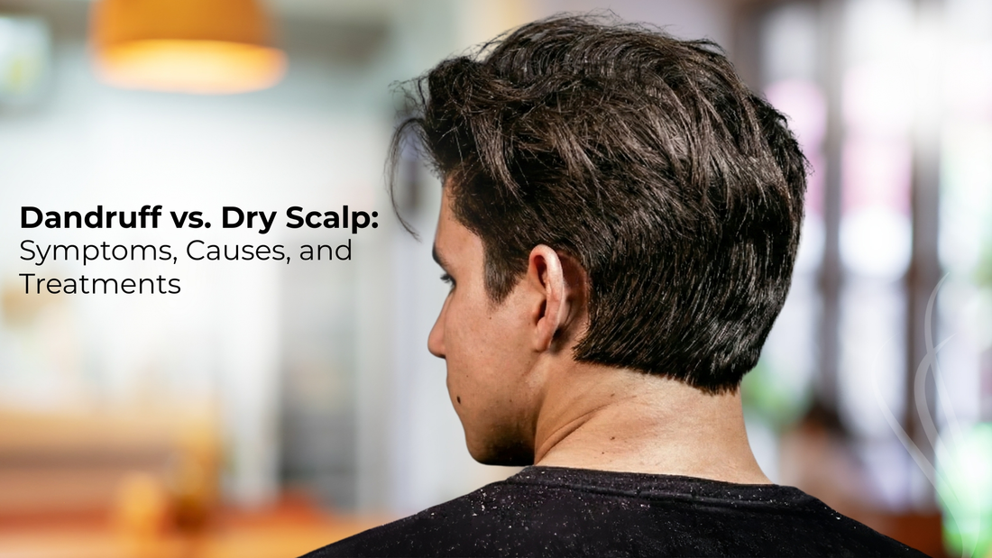 dandruff vs dry scalp