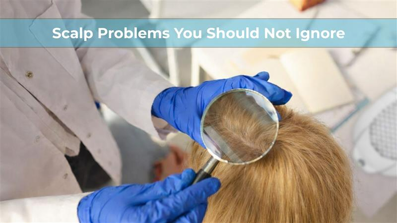 scalp problems you should not ignore