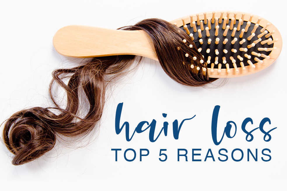 The Top Five Causes Of Hair Loss In Women