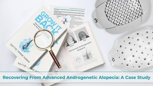 recovering from advanced androgenetic alopecia: a case study