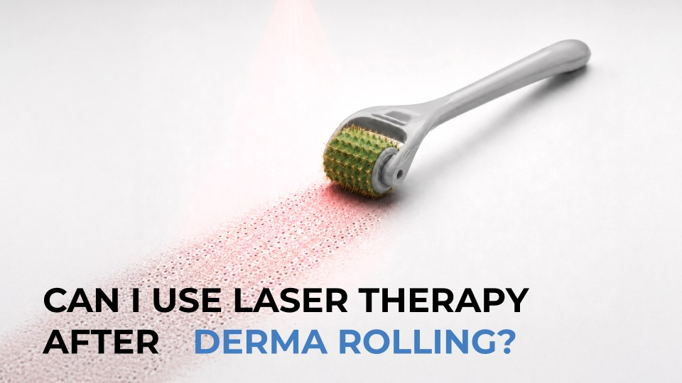 can i use laser therapy after derma rolling
