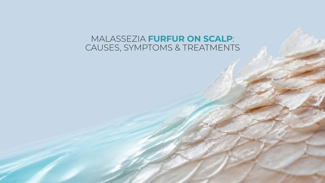 malassezia furfur on scalp