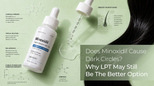 does minoxidil cause dark circles