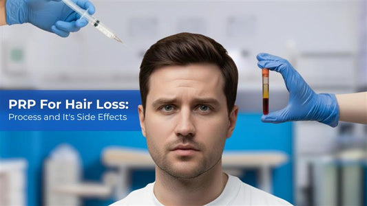 prp for hair loss: it's process and side effects
