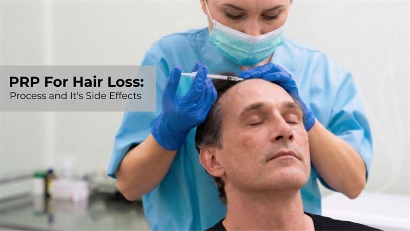 prp therapy for hair loss