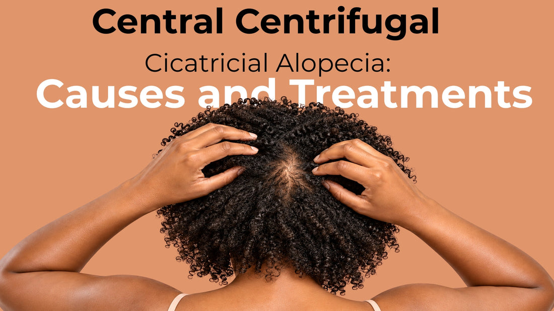 central centrifugal cicatricial alopecia