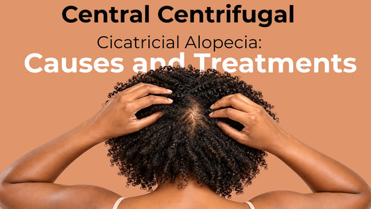 central centrifugal cicatricial alopecia
