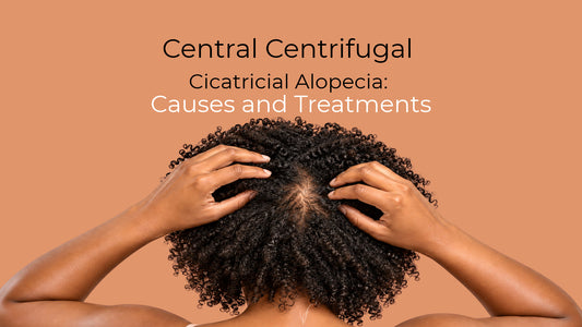 causes and treatments of central centrifugal cicatricial alopecia