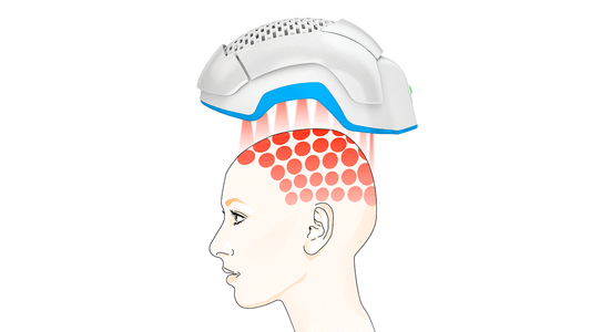 7 laser hair therapy myths debunked