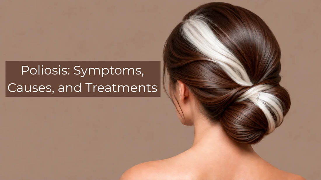 symptoms causes and treatments of poliosis