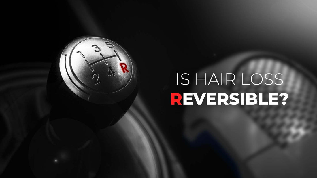 is hair loss reversible