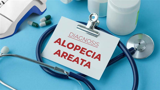 alopecia areata