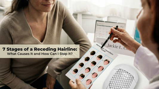 7 stages of a receding hairline