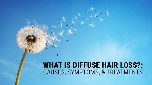 what is diffuse hair loss